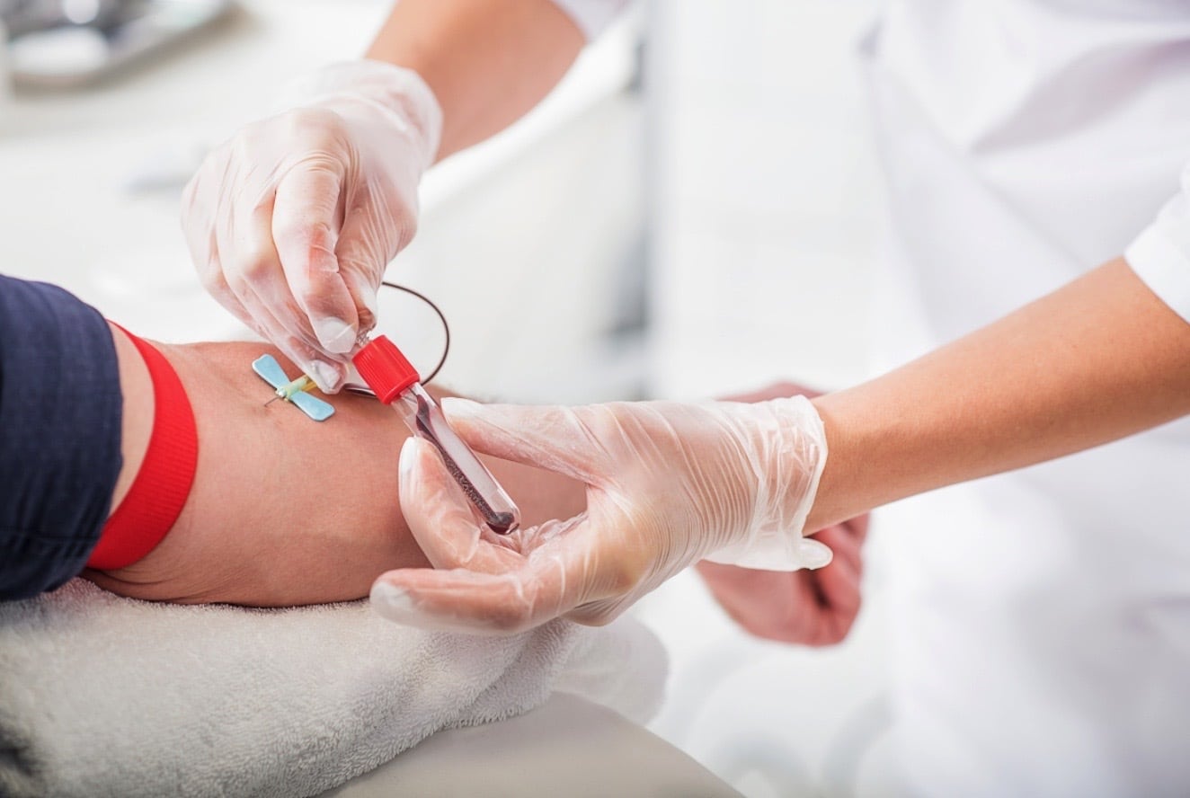青山メディカルクリニック(表参道)のがん超早期発見検査MyR-Cancerを受けました